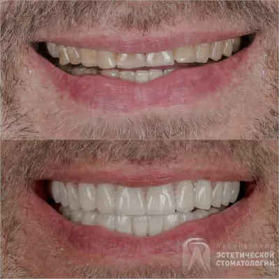 Лаборатория эстетической стоматологии