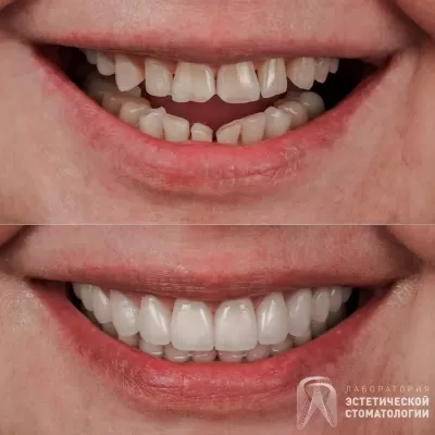 Лаборатория эстетической стоматологии