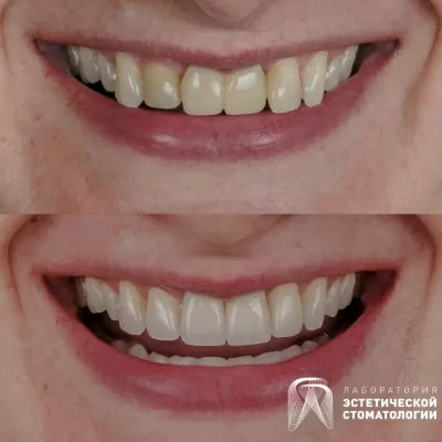 Лаборатория эстетической стоматологии