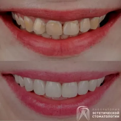 Лаборатория эстетической стоматологии