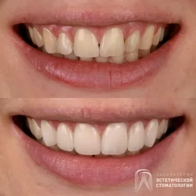 Лаборатория эстетической стоматологии