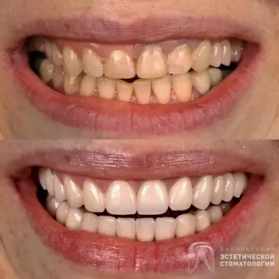 Лаборатория эстетической стоматологии