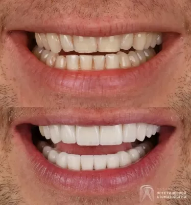 Лаборатория эстетической стоматологии