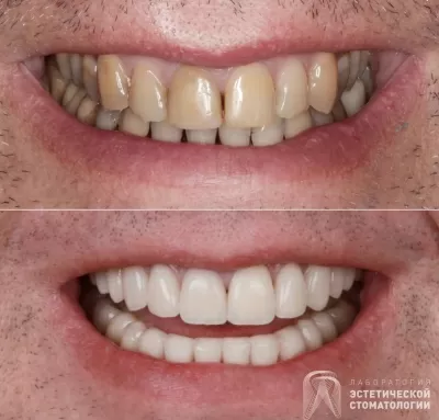 Лаборатория эстетической стоматологии