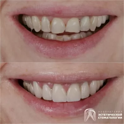 Лаборатория эстетической стоматологии