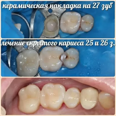 Хорошая стоматология