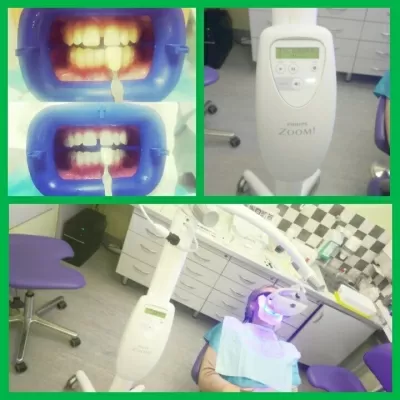 Стоматологическая клиника 33-й Зуб