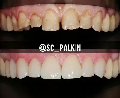 Стоматологический центр Палкинъ