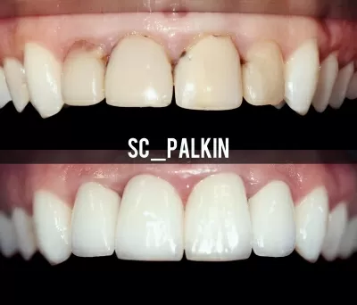 Стоматологический центр Палкинъ