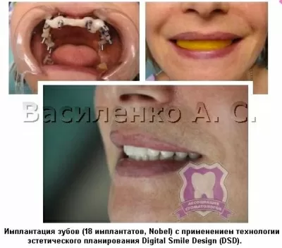 Ассоциация стоматологов