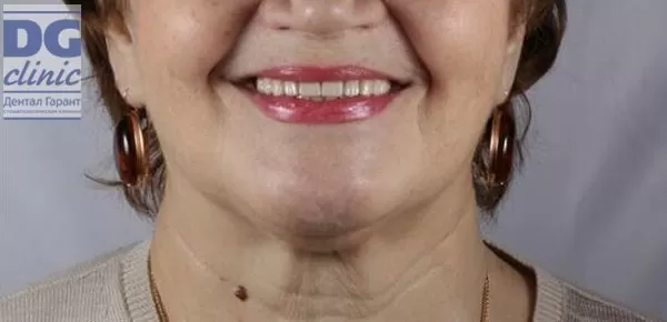 Стоматология Дентал Гарант