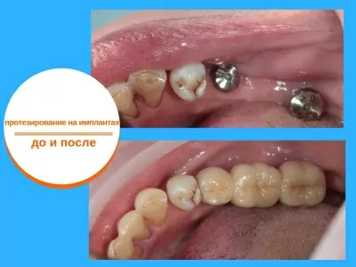 Стоматология доктора Лившиц