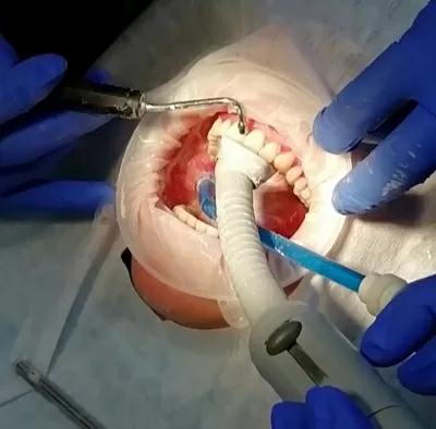 Космодентис