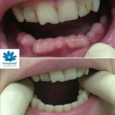 Белозубофф