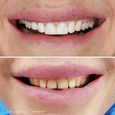 Доктор Стом