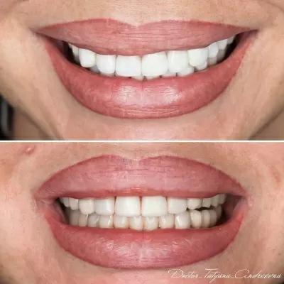 Доктор Стом