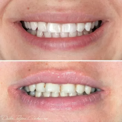 Доктор Стом