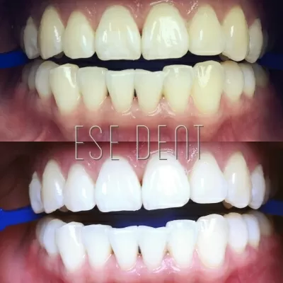Стоматология ЕСЕ ДЕНТ
