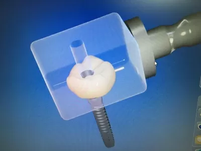 Стоматология ЕСЕ ДЕНТ