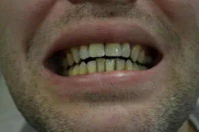 Ультрадент