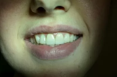 Ультрадент