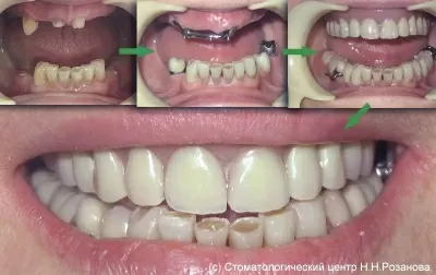 Стоматологический центр доктора Розанова