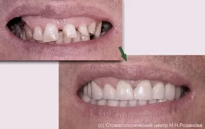 Стоматологический центр доктора Розанова