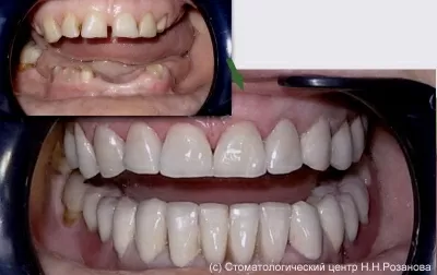 Стоматологический центр доктора Розанова