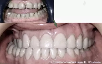 Стоматологический центр доктора Розанова