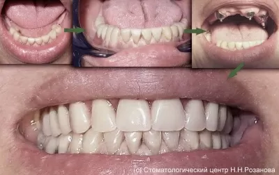 Стоматологический центр доктора Розанова