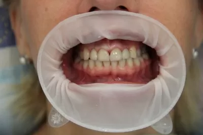 Стоматология Витаника