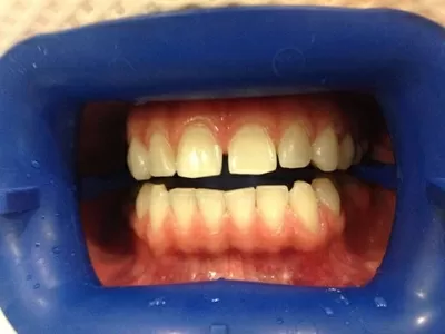 Стоматология Витаника