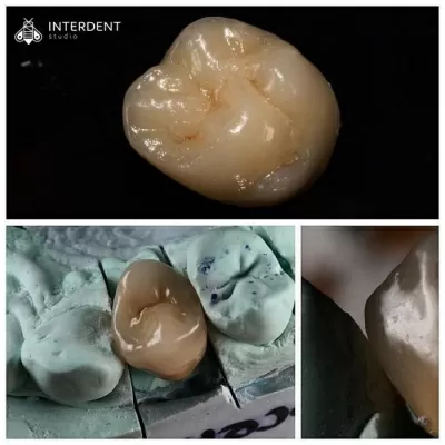 Интердент Студио