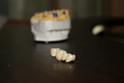 Комплексная стоматология