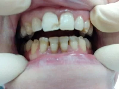 Доктор Дент