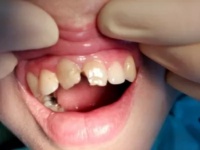 Доктор Дент