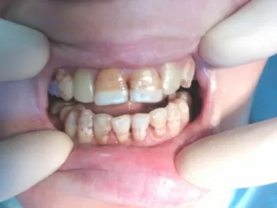 Доктор Дент