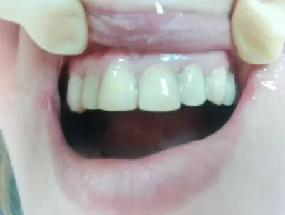 Доктор Дент