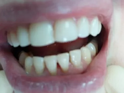 Доктор Дент