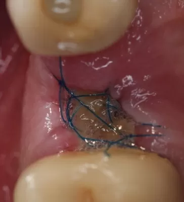 Доктор Дент