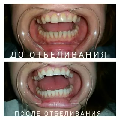 Твой стоматолог