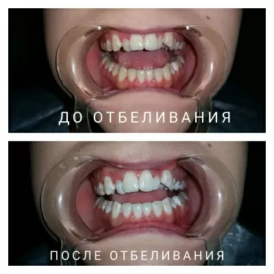 Твой стоматолог