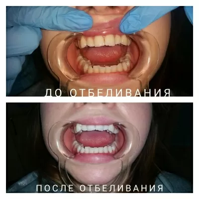 Твой стоматолог