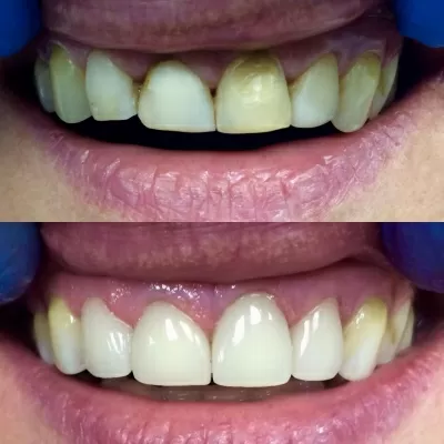 Клиника эстетической стоматологии и косметологии Дебют