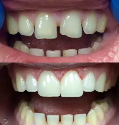 Клиника эстетической стоматологии и косметологии Дебют