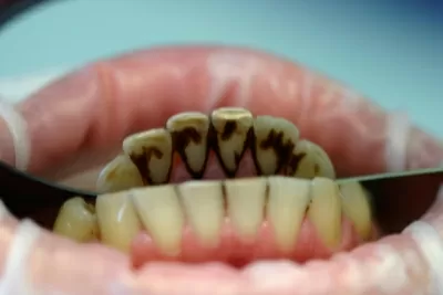 Современный стоматологический комплекс