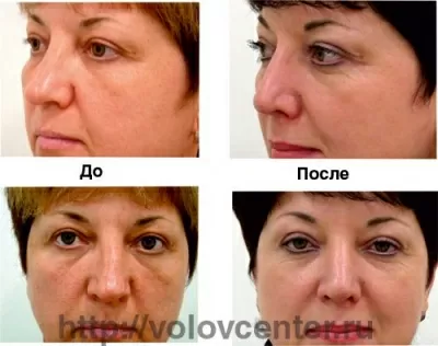 Амбулаторный центр № 1