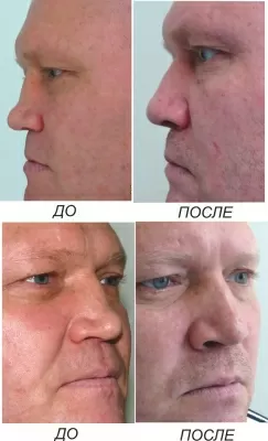 Амбулаторный центр № 1