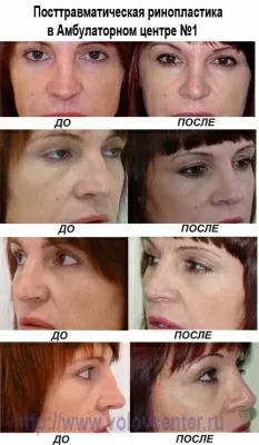 Амбулаторный центр № 1