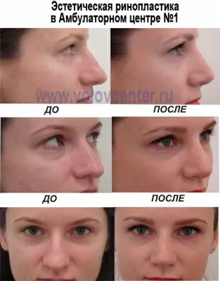 Амбулаторный центр № 1